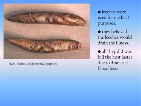 why were leeches used